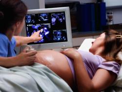 как поднять плаценту при беременности