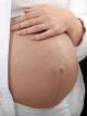Многоводие у беременных - причины
