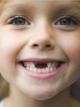 Какие зубы выпадают у детей?